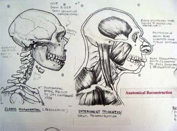 Anatomical restoration of skull